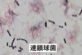 赤ちゃんに問題となる母の感染症- B群連鎖球菌-連鎖球菌の画像
