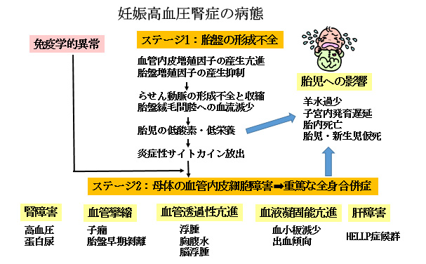赤ちゃんに問題となる妊娠合併症-妊娠高血圧症候群-妊娠高血圧腎症の病態