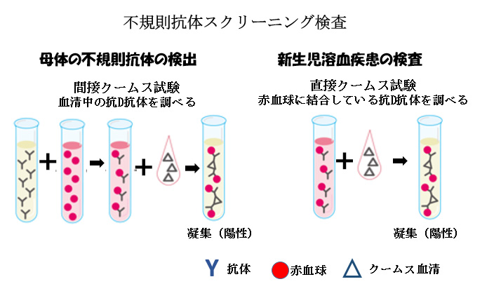 赤ちゃんに問題となる妊娠合併症 -血液型不適合妊娠-不規則抗体スクリーニング検査