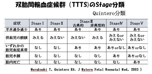 赤ちゃんに問題となる妊娠合併症-双胎-双胎間輸血症候群(TTTS)のStage分類