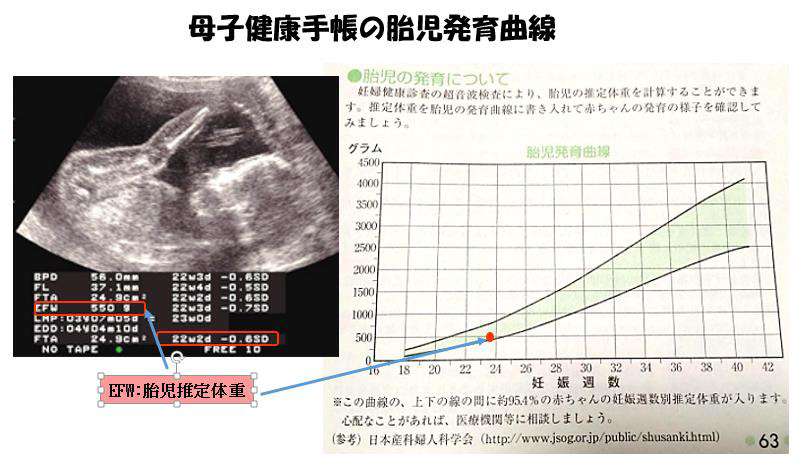 赤ちゃんに問題となる妊娠合併症-胎児発育不全-母子健康手帳の胎児の発育曲線