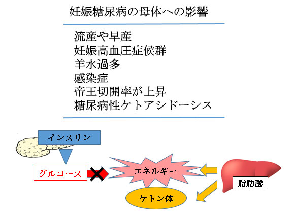 赤ちゃんに問題となる 妊娠合併症-妊娠糖尿病-妊娠糖尿病の母体への影響