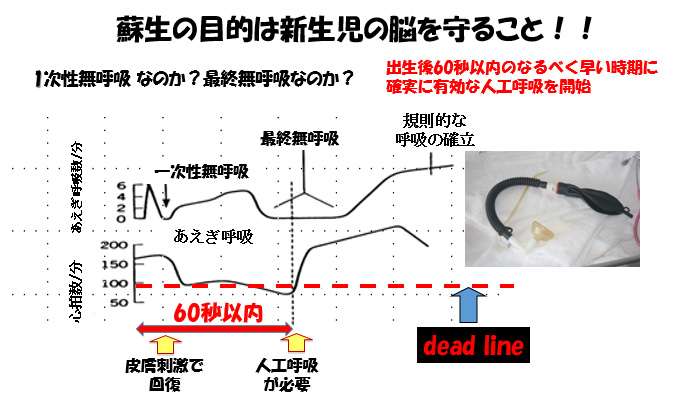 胎児から新生児への適応障害-新生児仮死-蘇生の目的は新生児の脳を守ること