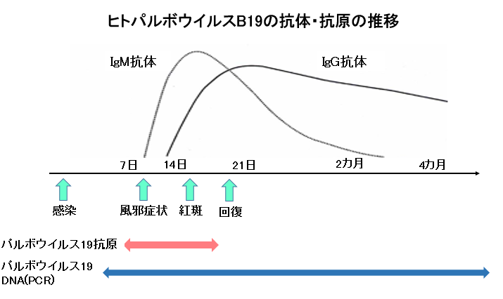 赤ちゃんに問題となる母の感染症-伝染性紅斑-ヒロパルボウイルスB19の抗体・抗原の推移