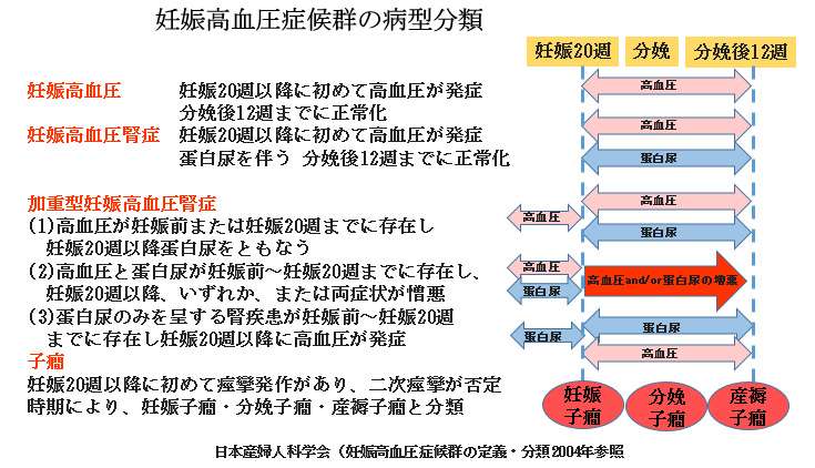 赤ちゃんに問題となる妊娠合併症-妊娠高血圧症候群-妊娠高血圧症候群の病型分類