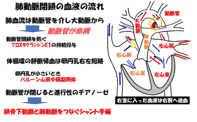 子宮外への適応-胎児循環から新生児循環へ-肺動脈閉鎖の血液の流れ