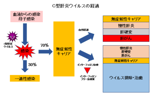 赤ちゃんに問題となるお母さんの感染症-C型肝炎ウイルス-C型肝炎ウイルスの経過