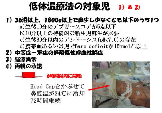 胎児から新生児への適応障害-新生児仮死-低体温療法の対象児