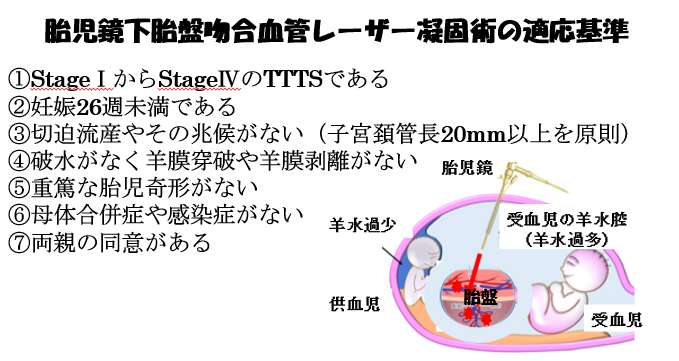赤ちゃんに問題となる妊娠合併症-双胎-胎児鏡下胎盤吻合血管レーザー凝固術の適応基準